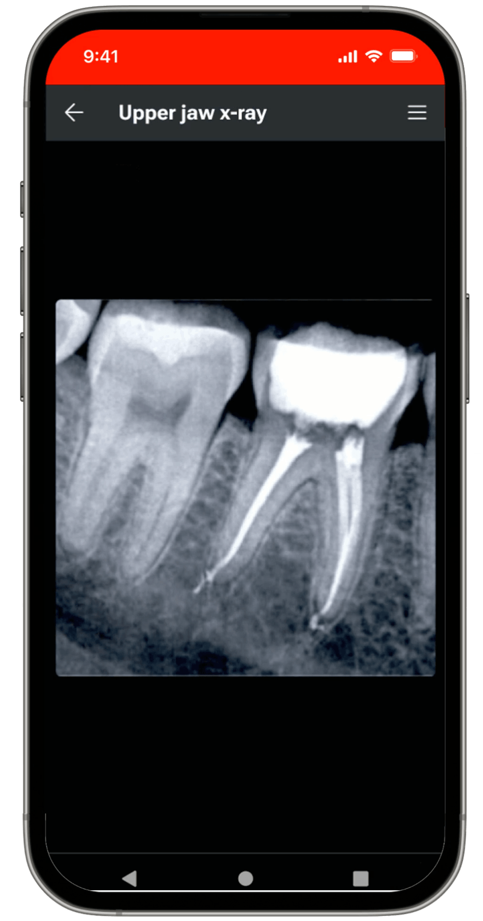 Patient viewing an X-ray shared through the Cair™ app